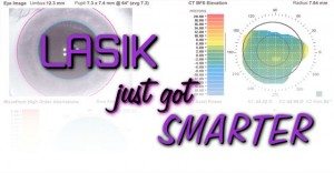 idesign lasik