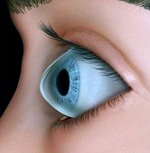 keratoconus side view
