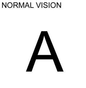 normal vision