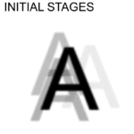 Keratoconus Initial Stages