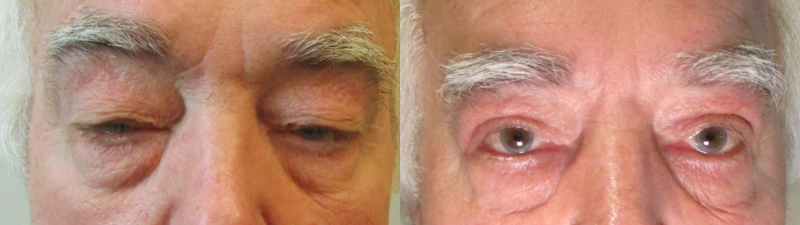 combined-image